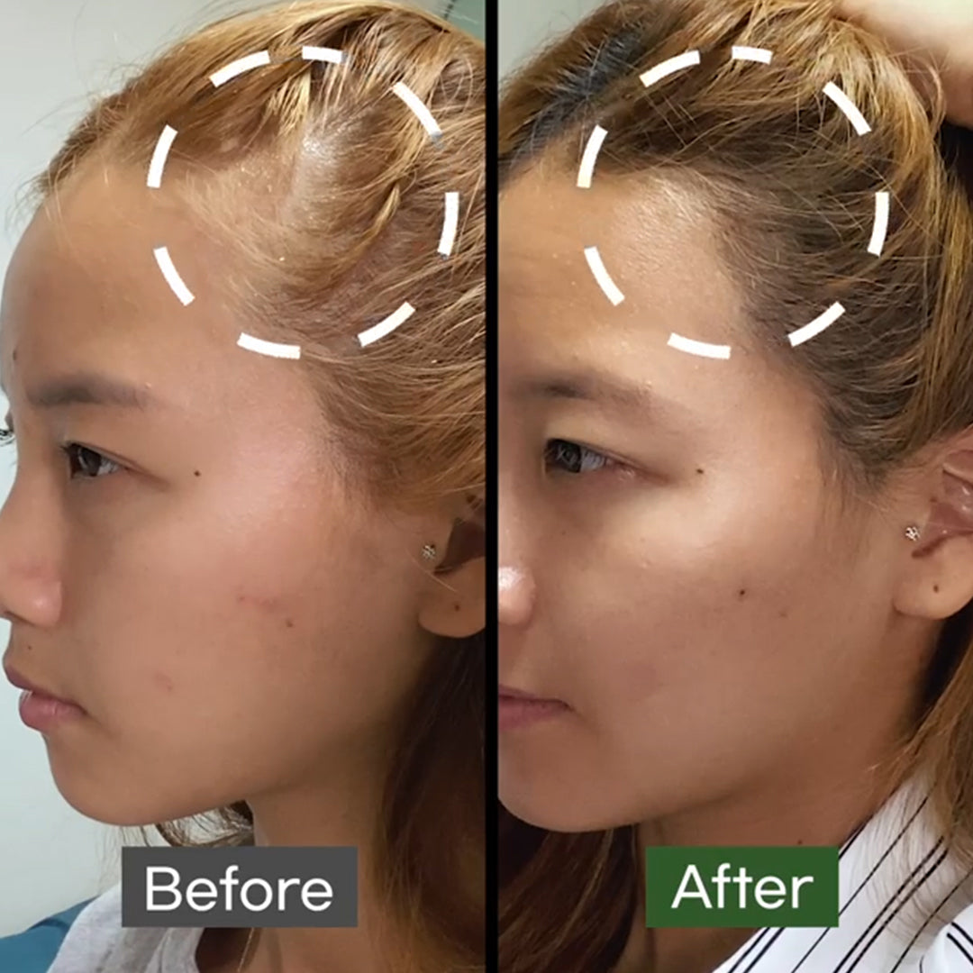 Some By Mi - CICA Pptide Anti Hair Loss Derma Scalp Tonic 150ML