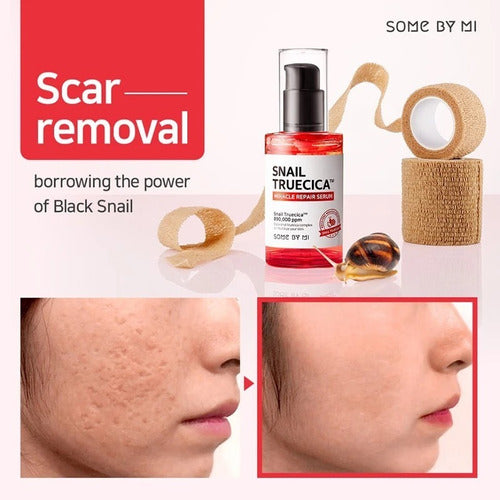 Some by Mi - Snail Truecica Miracle Repair Serum 50ml